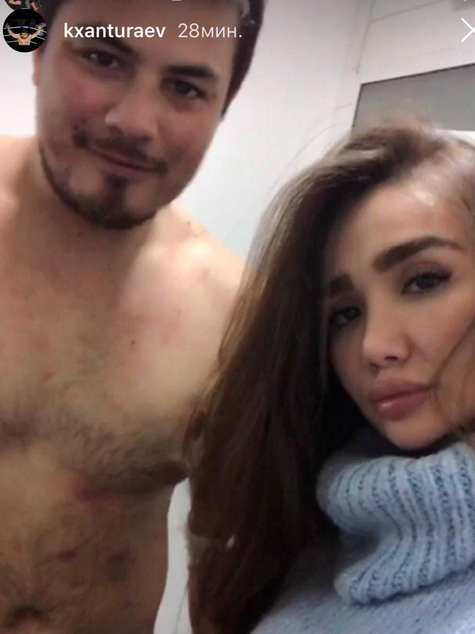 Jinsiy olatni rentgenogrammasi vagina fotosurati