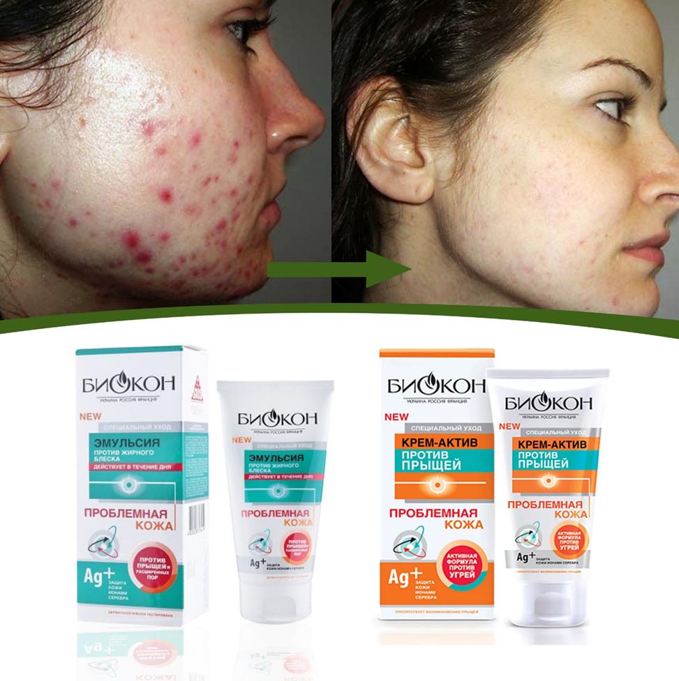 Moskva viloyatidagi fohishalar