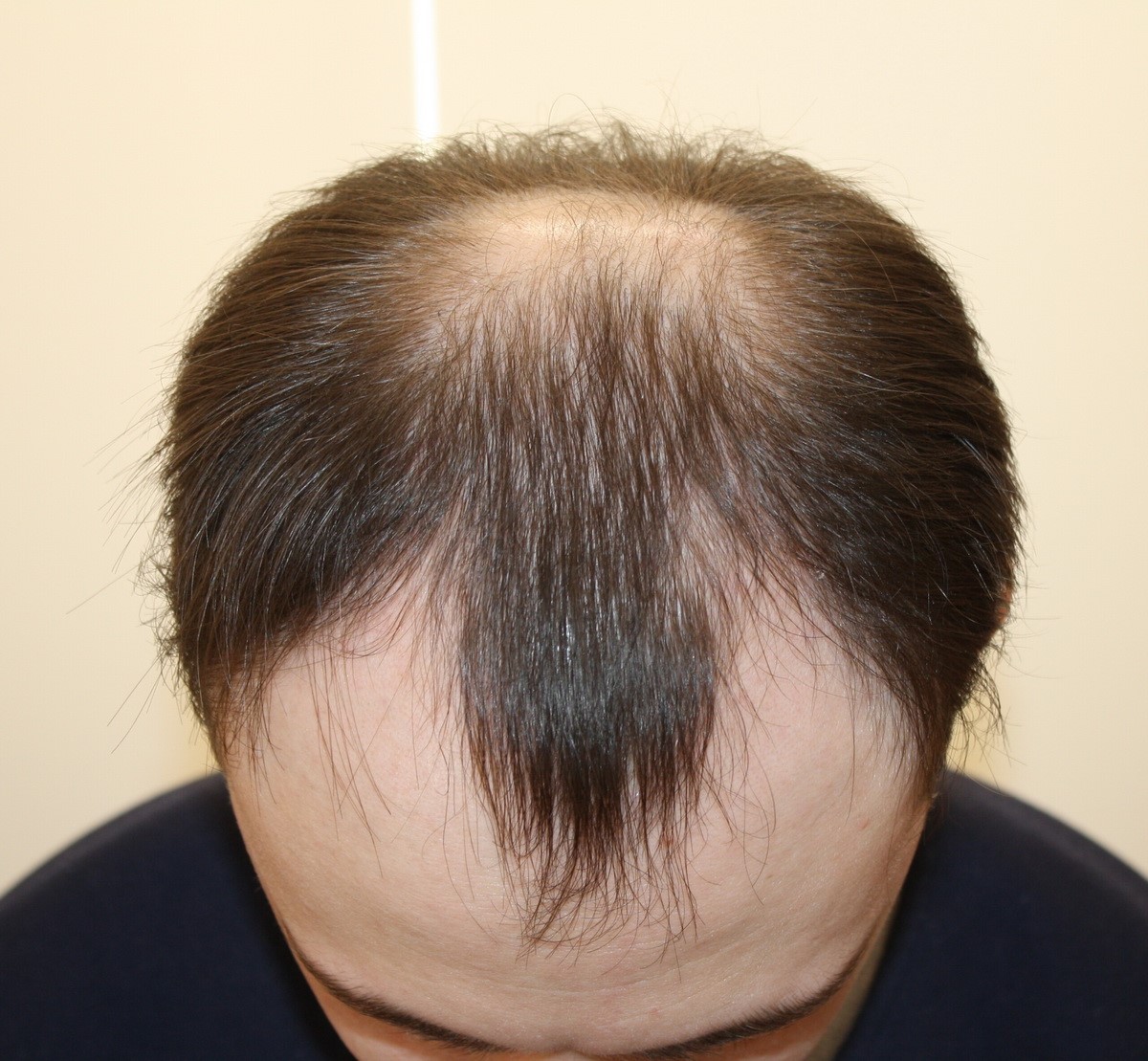 Rus jojalari onanizm Bikinidagi sariq qiz