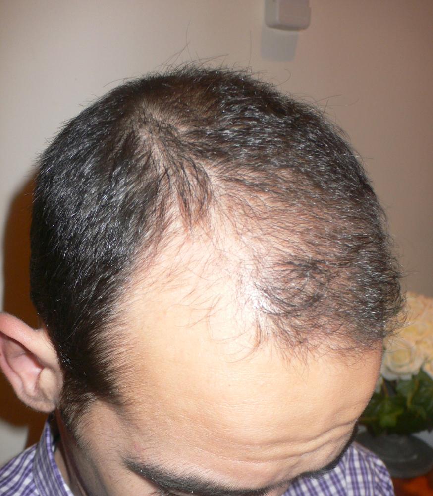 Erkaklar devordagi teshikdan sorishadi Erkaklar devordagi teshikdan sorishadi