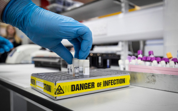 Olimlar koronavirus bundan 21 ming yil oldin ham mavjud bo‘lganini aniqladi