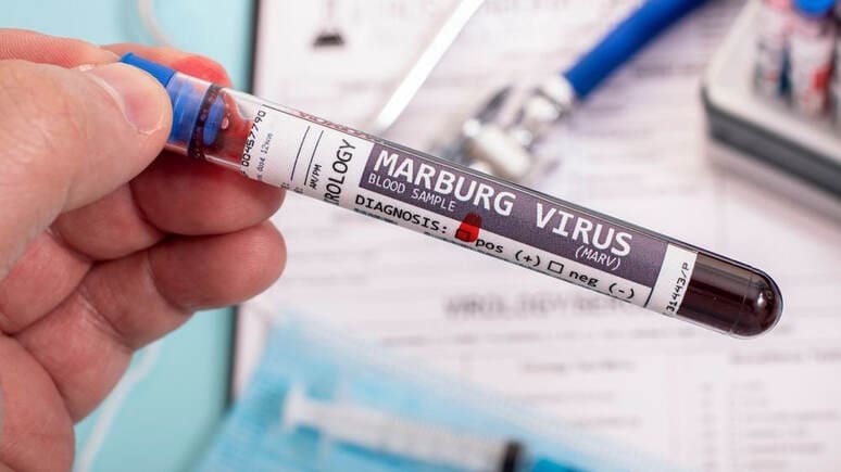 <p><b>JSST Marburg virusining global epidemiyasi xavfidan ogohlantirdi </b></p>