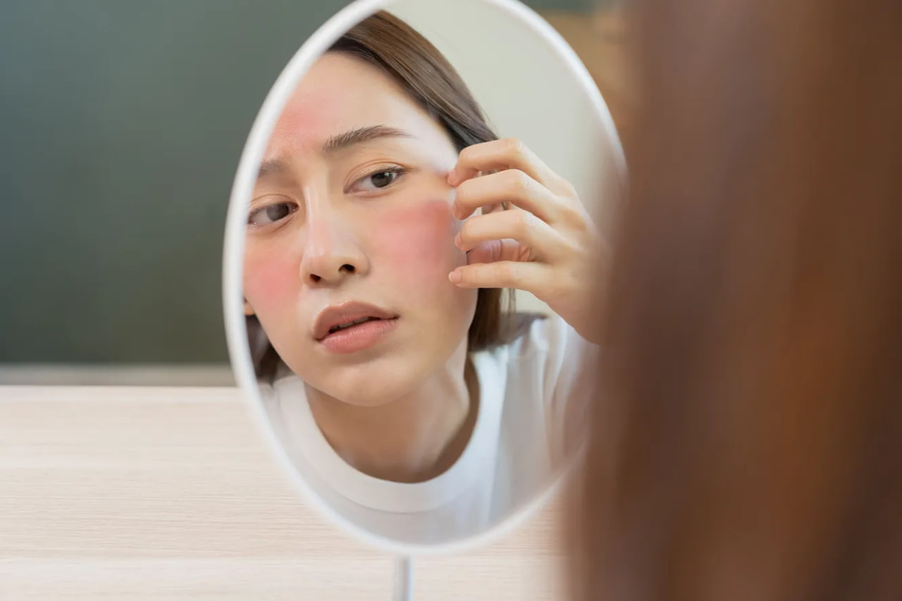 <p><b><strong>Dermatologlar tavsiyasi: e&rsquo;tibordan chetda qoldirmaslik kerak bo&lsquo;lgan teridagi o&lsquo;zgarishlar</strong></b></p>