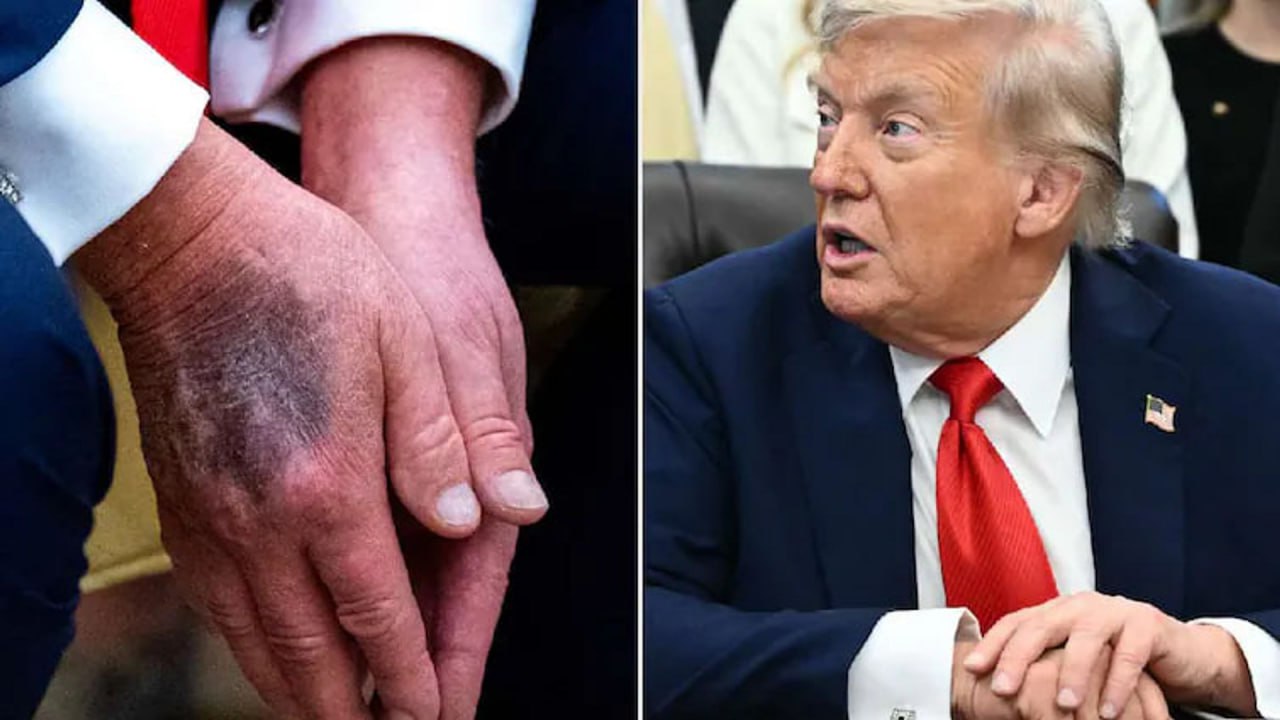 Rumors of Trump’s death spread, but evidence falls short