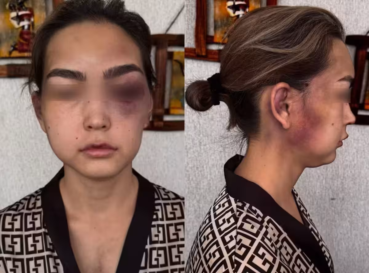 В Сурхандарье мужчина жестоко избил свою жену