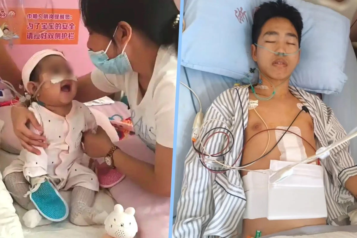 Ota qiziga jigarini berib, xarajatni tejash uchun o‘zi uyda davolandi