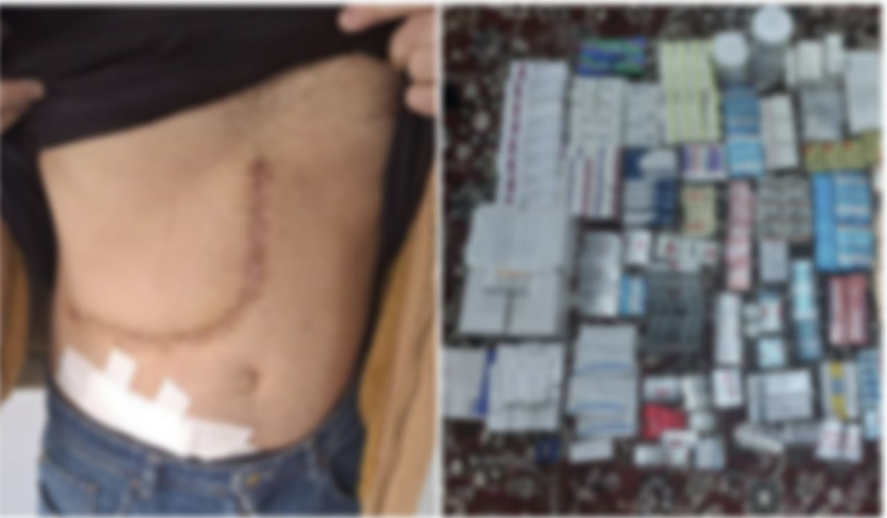 В Узбекистане раскрыли преступную группу, занимавшуюся торговлей человеческими органами