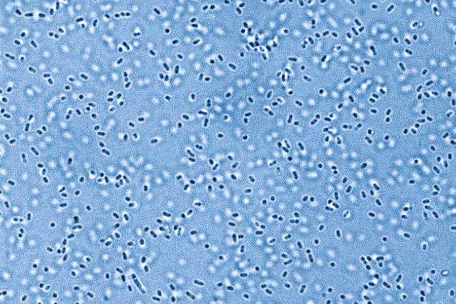 Olimlar ilk bor abadiy muzlikdagi qadimiy mikroorganizmlarni uyg‘otdi