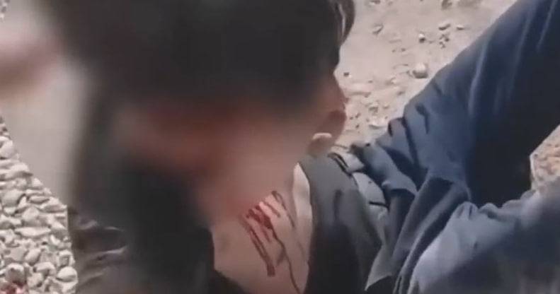 Qashqadaryoda 19 yoshli taksichi yigit mashinasiga o‘tirgan qizning qarindoshlari tomonidan kaltaklandi