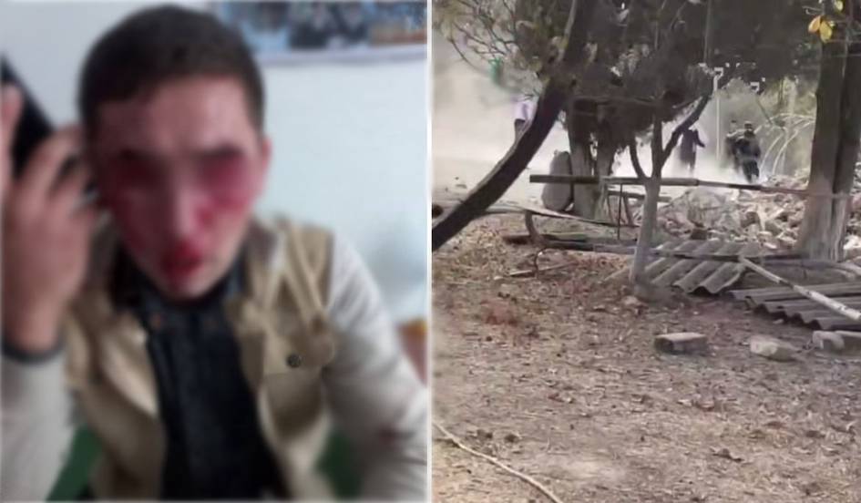 Samarqandda oʻqituvchi mast erkak tomonidan kaltaklandi