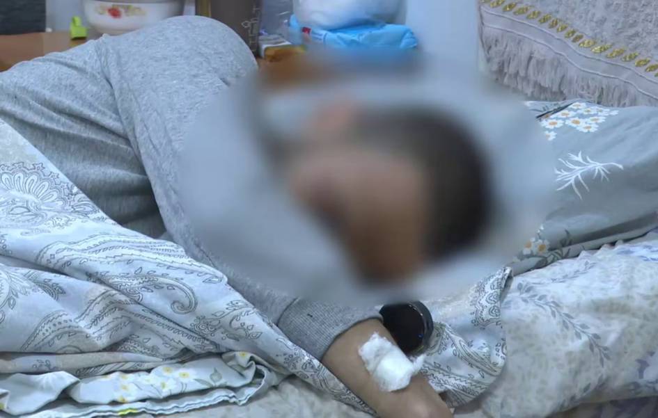 В Ташкенте 24-летний парень лишился части руки из-за пиротехники