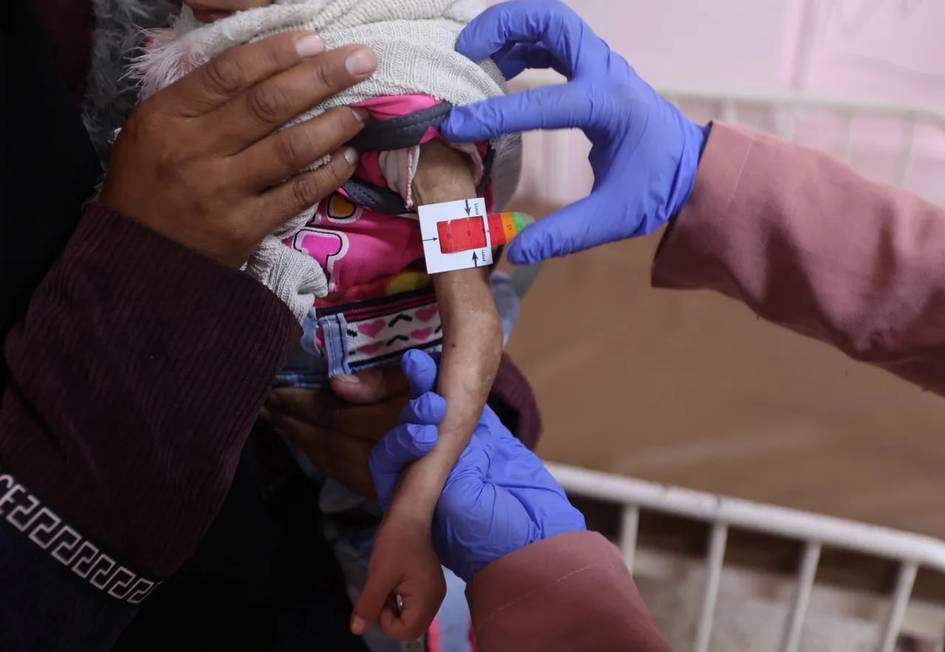 В Газе число детей, страдающих от недоедания, достигло 95 тысяч