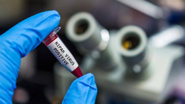 Вирус Нипах в Узбекистане не зафиксирован — Санэпидкомитет