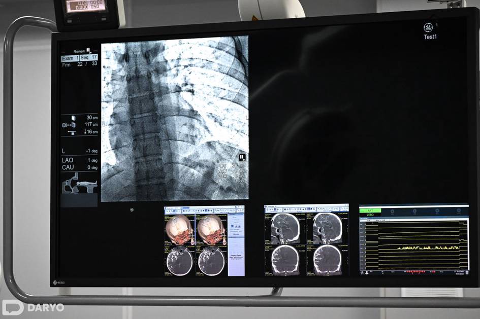 Uzbekistan rolls out AI-supported emergency care for heart and stroke cases