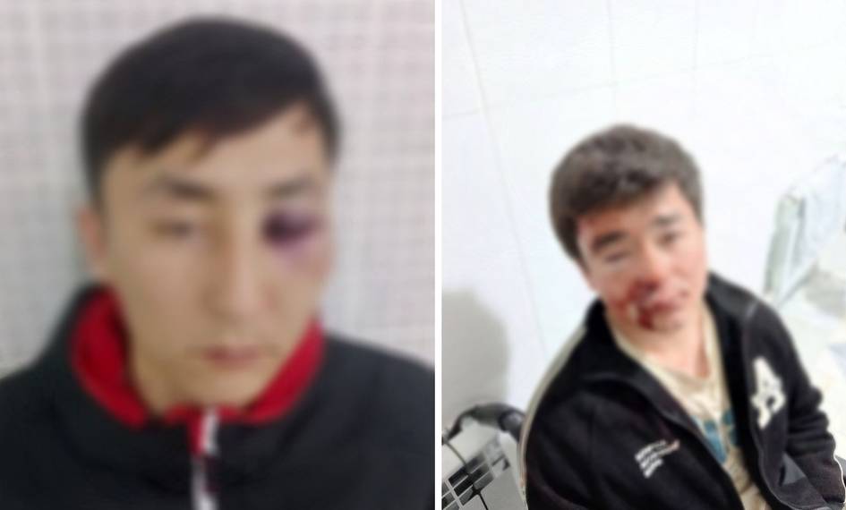 Қашқадарёда ўзаро келишмовчилик оқибатида 3 йигит калтакланди