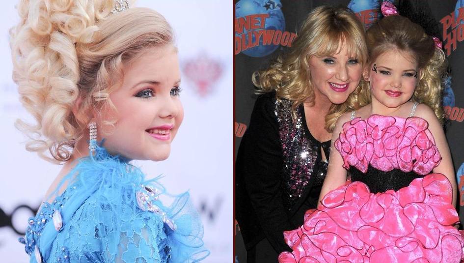 Onasining orzulari qurboni: bolaligida 300 ta go‘zallik tanlovida g‘olib chiqqan “tirik qo‘g‘irchoq” hozir qanday ko‘rinishda?