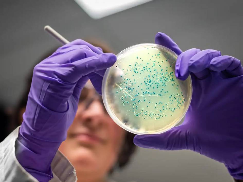 Антибиотикларга чидамлилик сабаб 2050 йилгача 40 млн киши ўлиши мумкин