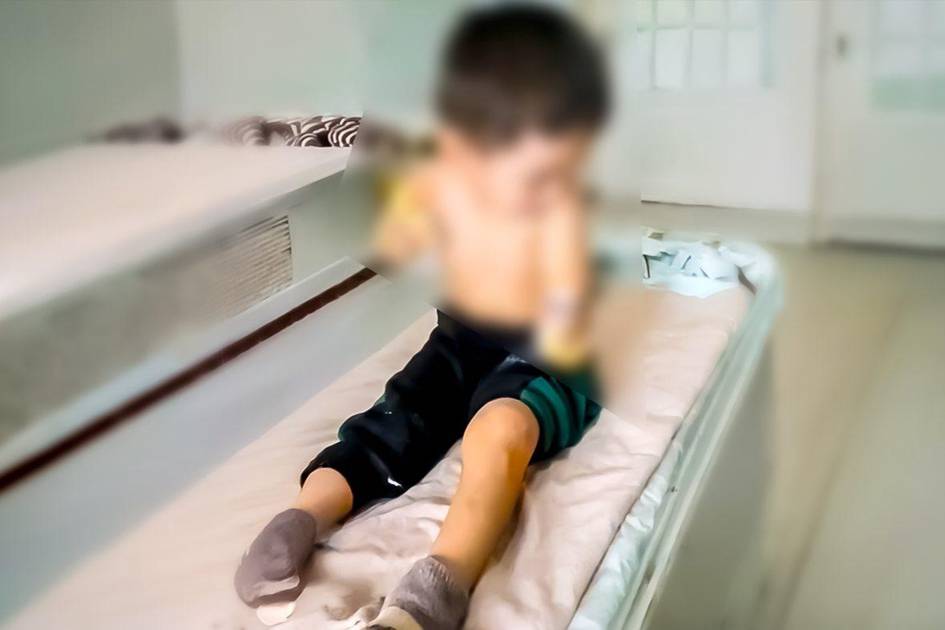 Mingbuloqda tok urishi oqibatida qo‘llari kesilgan 4 yoshli bola: hokimlik rasmiy izoh berdi