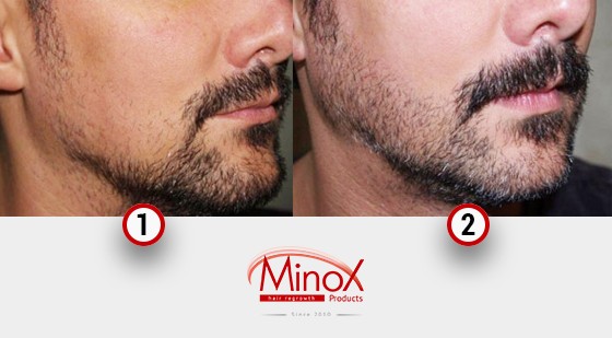 Uzun dildo eshak porno onlayn Sparkle va Discord jinsiy aloqa