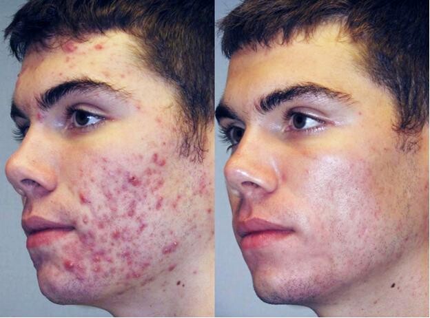 Uyqu paytida jinsiy aloqa qilish