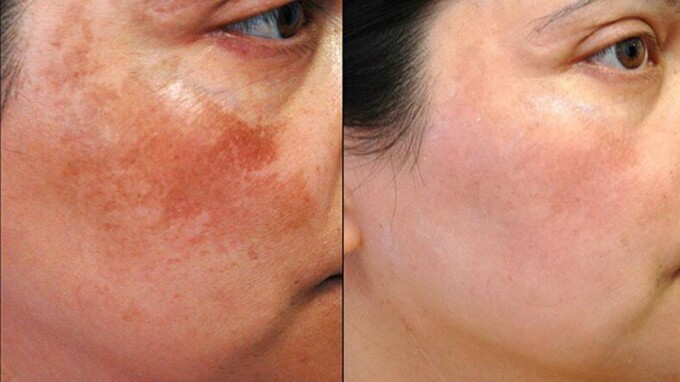 Kocha jinsiy aloqa videolarini tomosha qiling Shirin külotlu porno rasmlar