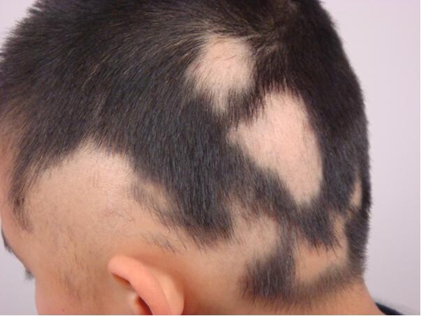 Yigitda kokrakli yalangoch qizlar kop