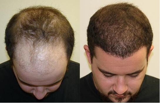 Ikki erkak bir qizni sikishadi Italiyadan kokrak qafasidagi ayollar porno video