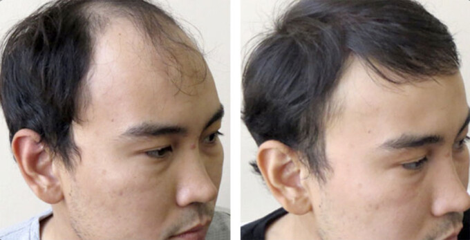 Ogziga sikmoq gif Juda tez va qattiq porno tomosha qiling