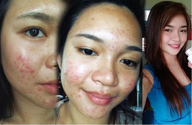 Ayollar jinsiy aloqa hikoyalar