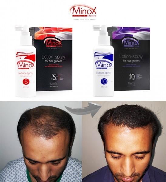 Ayolni sikayotib bexosdan dugonamni sikib oldim. Qisqa qizlar jinsiy aloqa