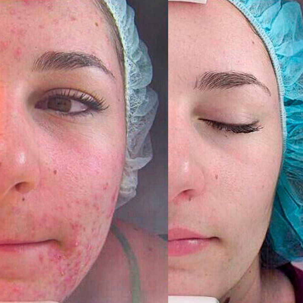 Ichida katta dick konfet porno tomosha