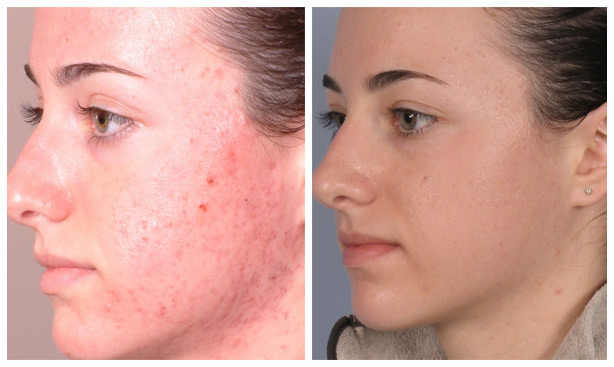 Olomon ichida Blowjob deepthroat Katta lablari bilan porno surat