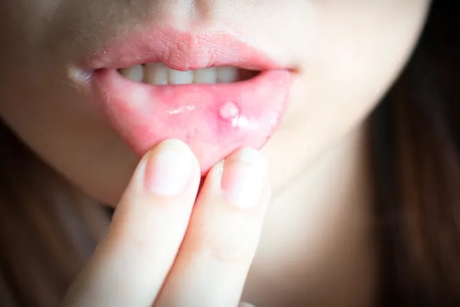 külot kiygan fohisha surati