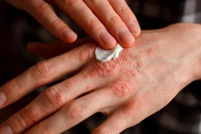 Topiqda jinsiy aloqa